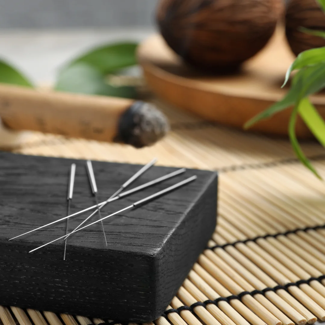 Chinese and Japanese Acupuncture - in San Francisco East Bay Area